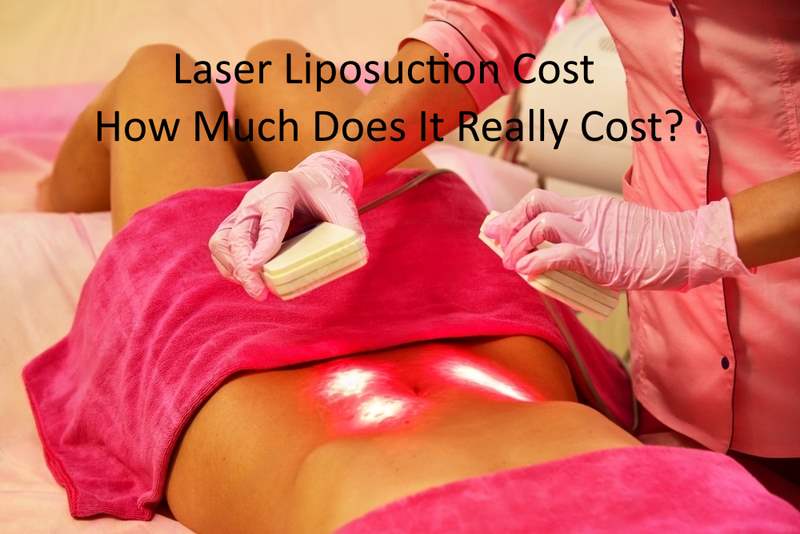 Laser Liposuction Cost