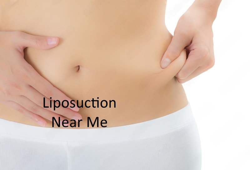 Liposuction Near Me