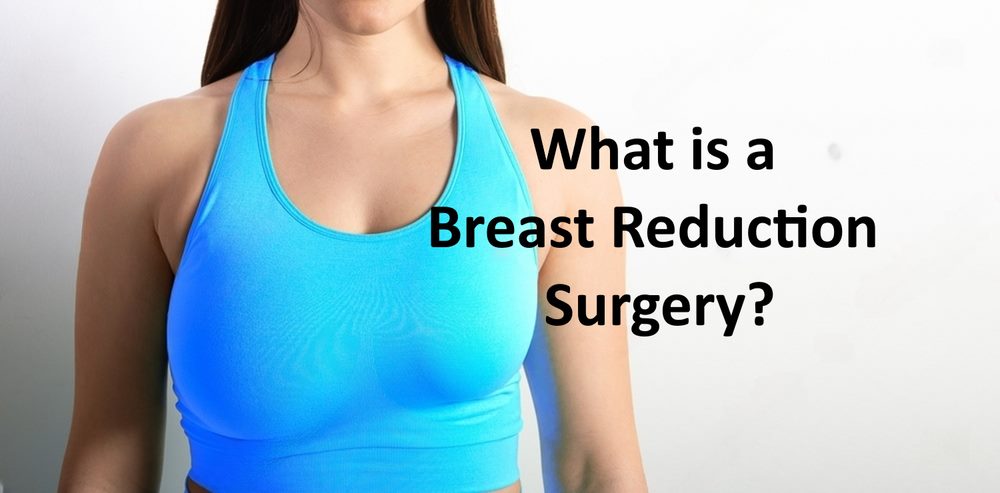 What is a Breast Reduction Surgery?