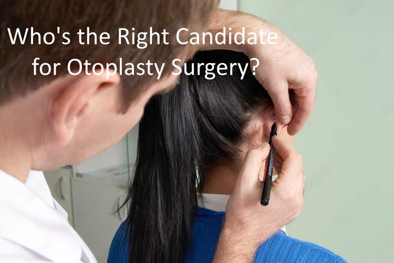 Otoplasty Surgery