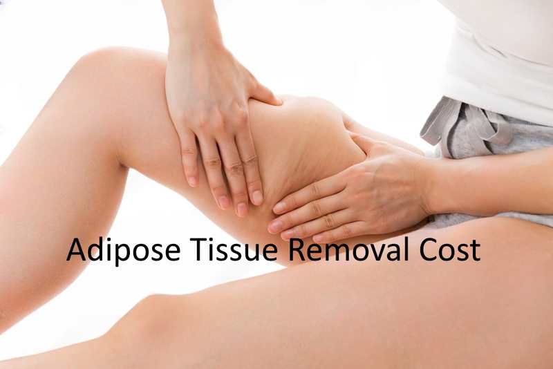 Adipose Tissue Removal Cost