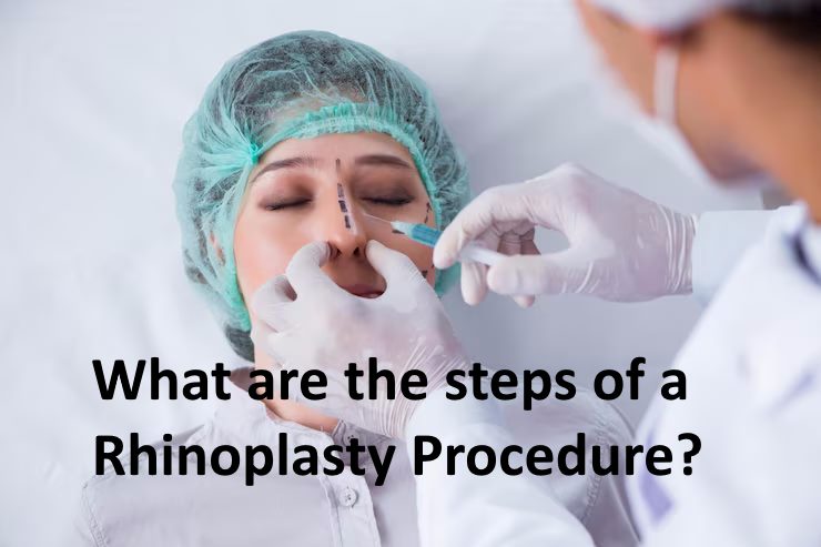 What are the steps of a Rhinoplasty Procedure?