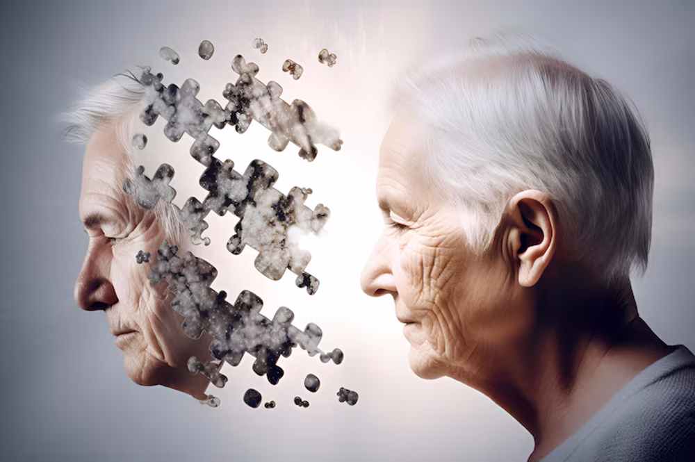 Understanding Alzheimer's Disease - Key Facts