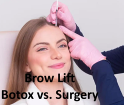 Brow Lift Botox Brow Lift: Botox vs. Surgery