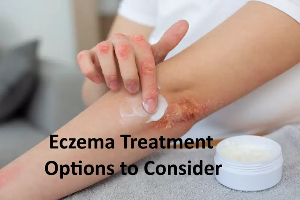 Eczema Treatment Options to Consider
