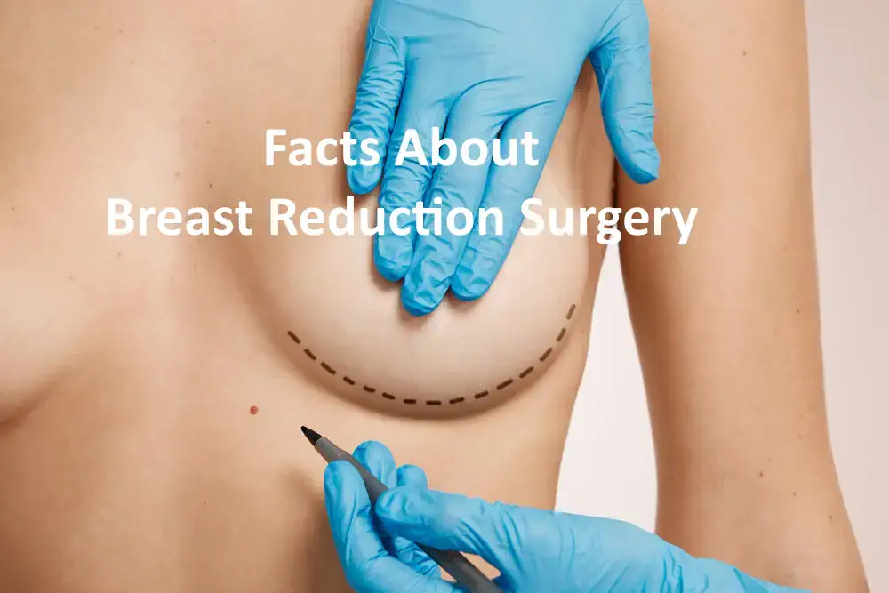 Facts About Breast Reduction Surgery