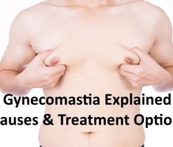 Gynecomastia Explained: Causes & Treatment Options