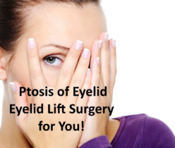 Ptosis of Eyelid: Eyelid Lift Surgery for You!