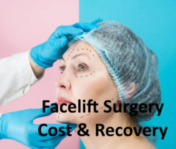 Facelift Surgery Cost, Recovery