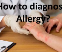 How to diagnose allergy?