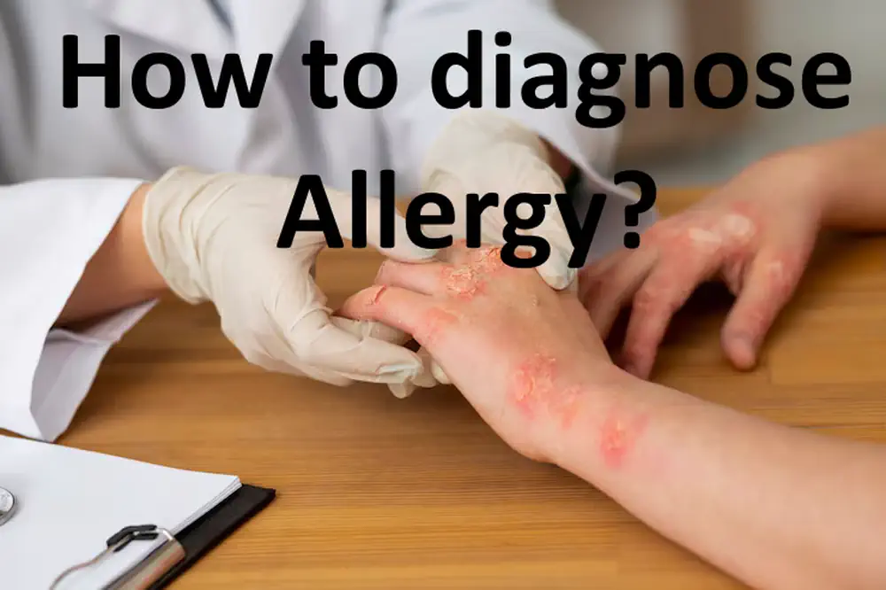 How to diagnose allergy?