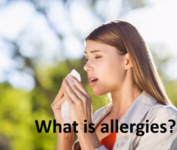 What is allergies?