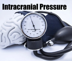 Intracranial Pressure: Causes & Treatments