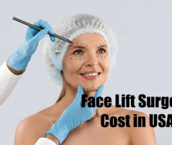 Face Lift Surgery Cost in USA