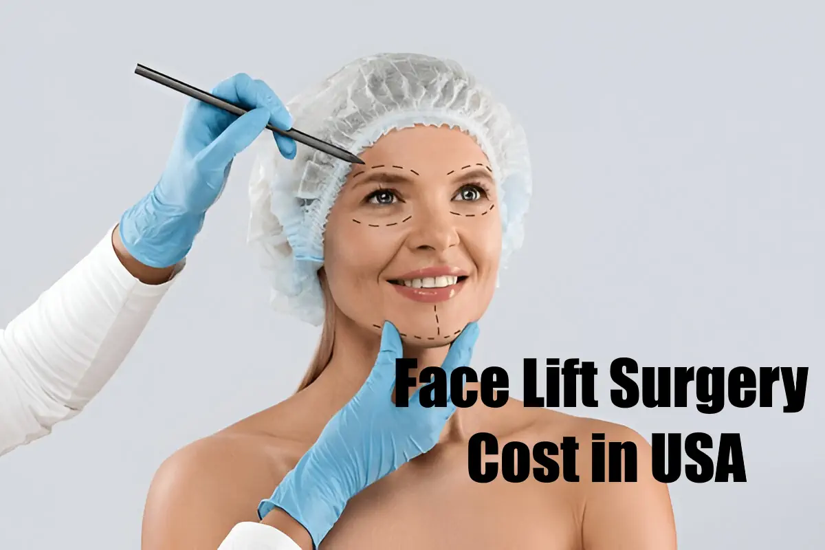 Face Lift Surgery Cost in USA